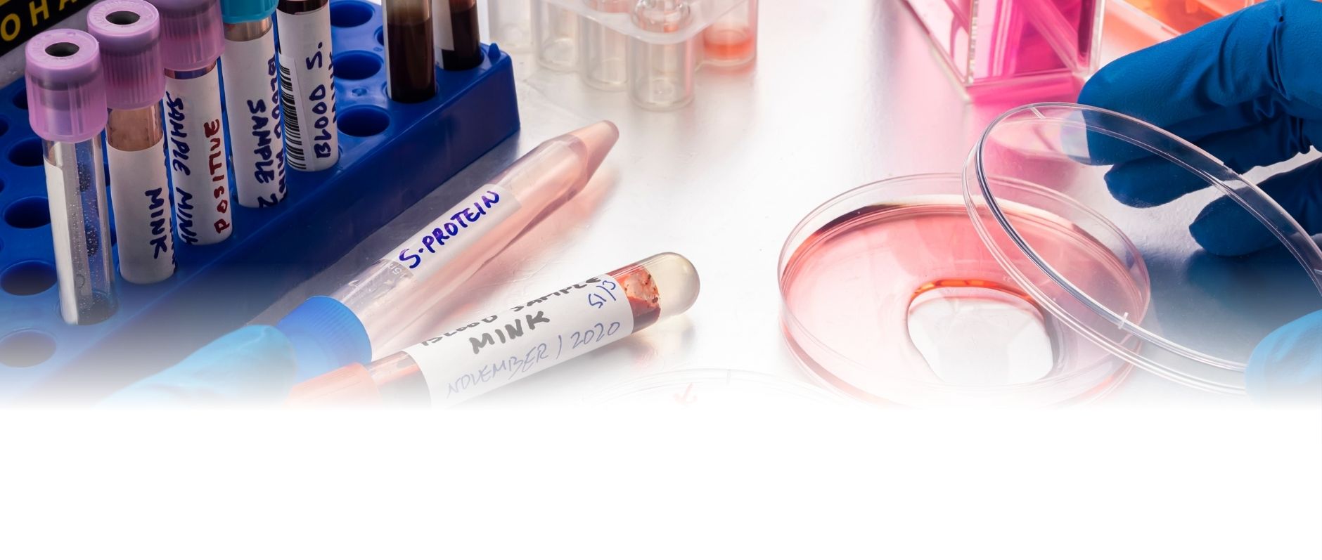 Shree Sai Pathology Blood Collection Centre