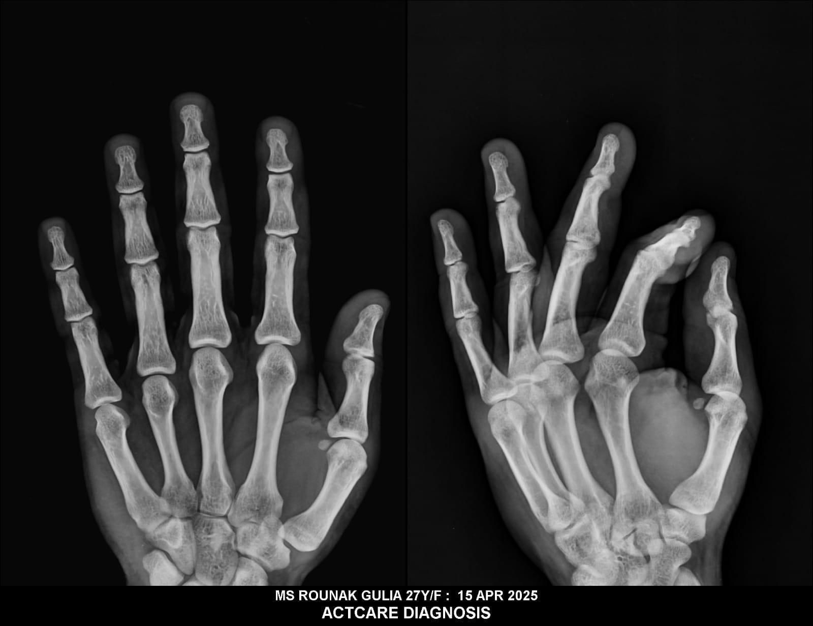 Actcare Diagnostic