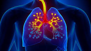 Asthama