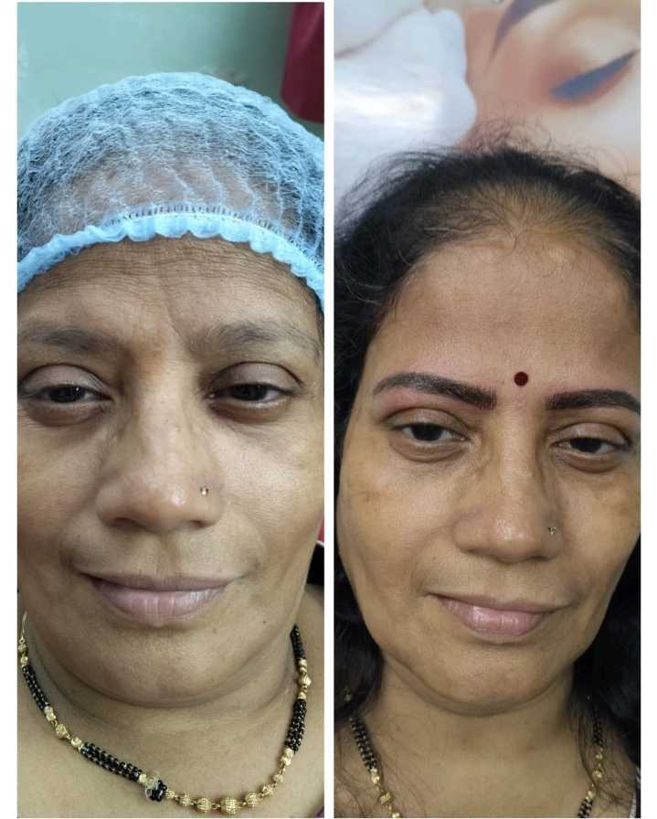 Sneha's beauty care