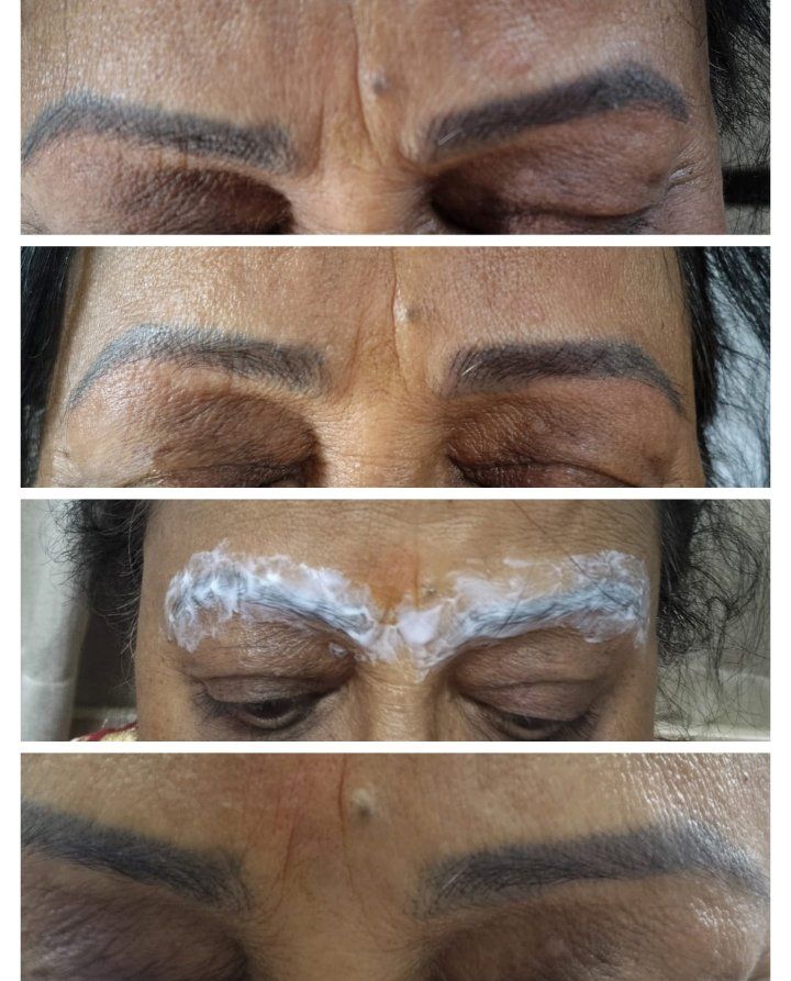 Sneha's beauty care