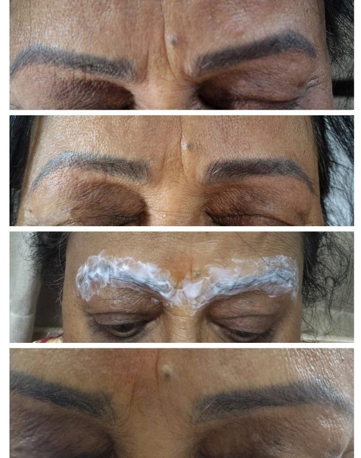 Sneha's beauty care