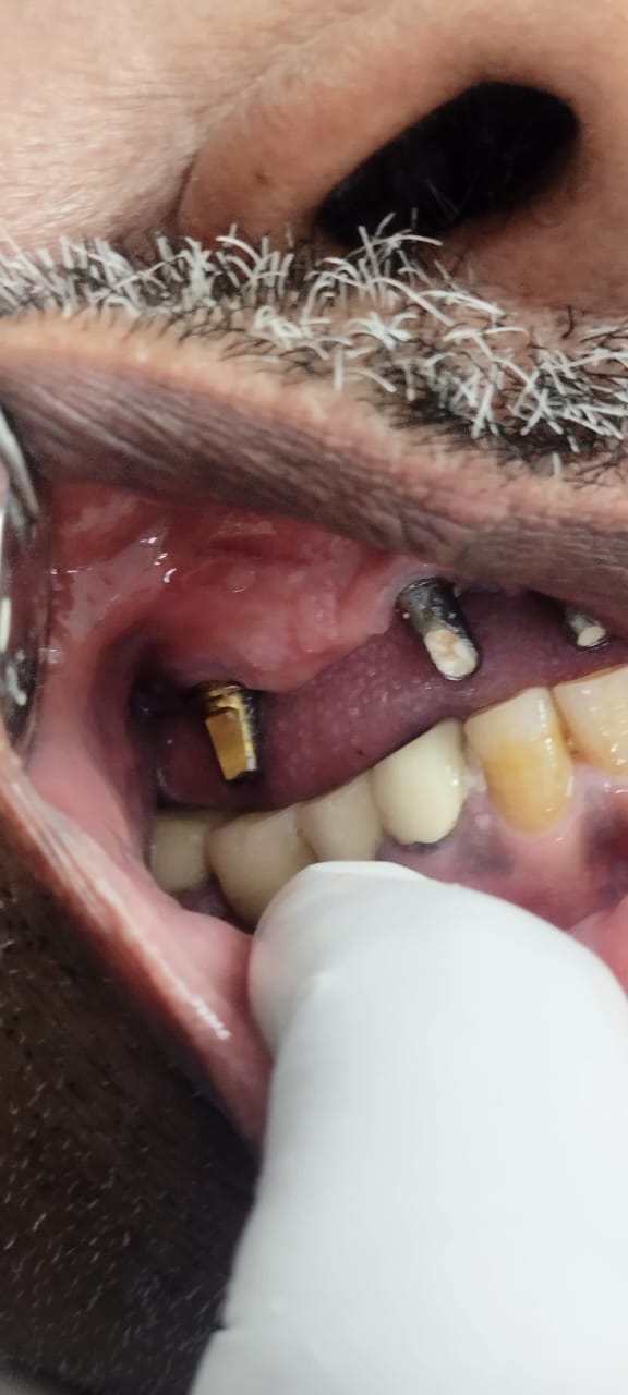 Balaji Dental Clinic