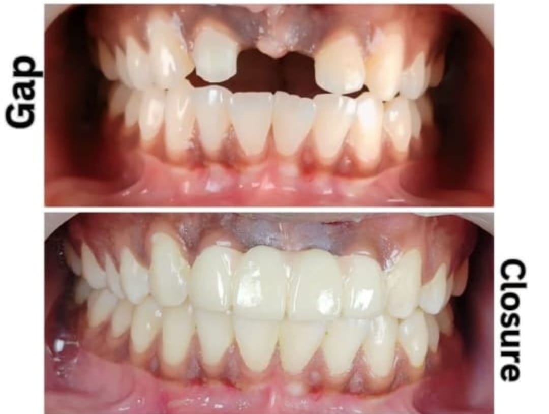 Balaji Dental Clinic