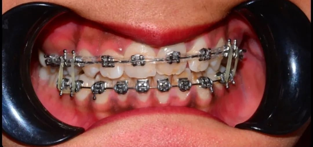 Balaji Dental Clinic
