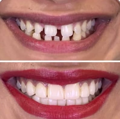 Balaji Dental Clinic