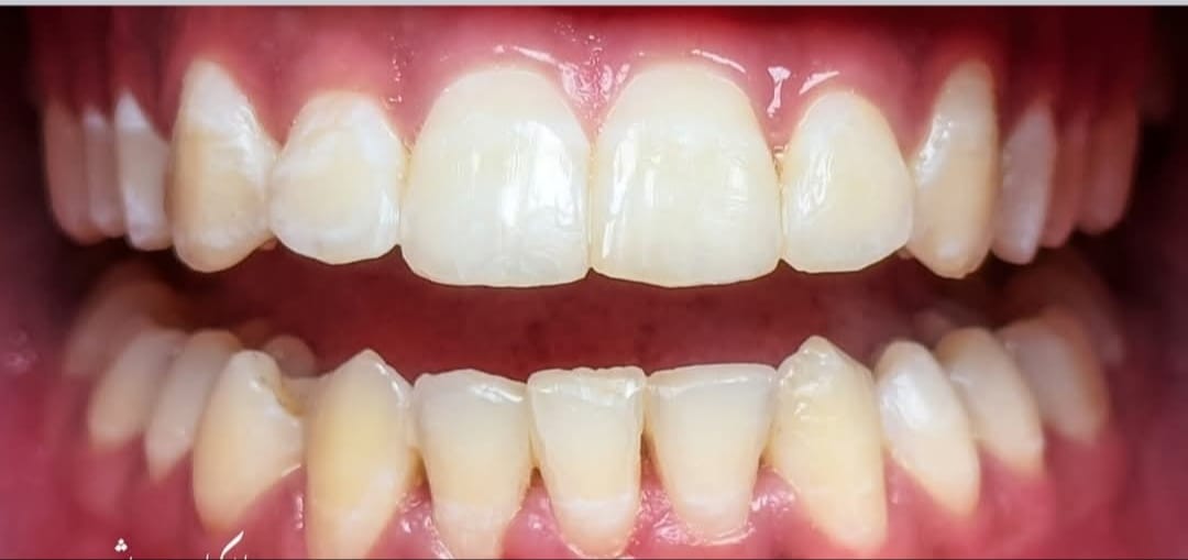 Balaji Dental Clinic