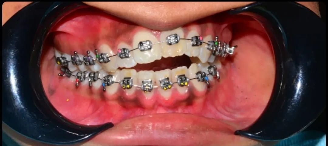 Balaji Dental Clinic