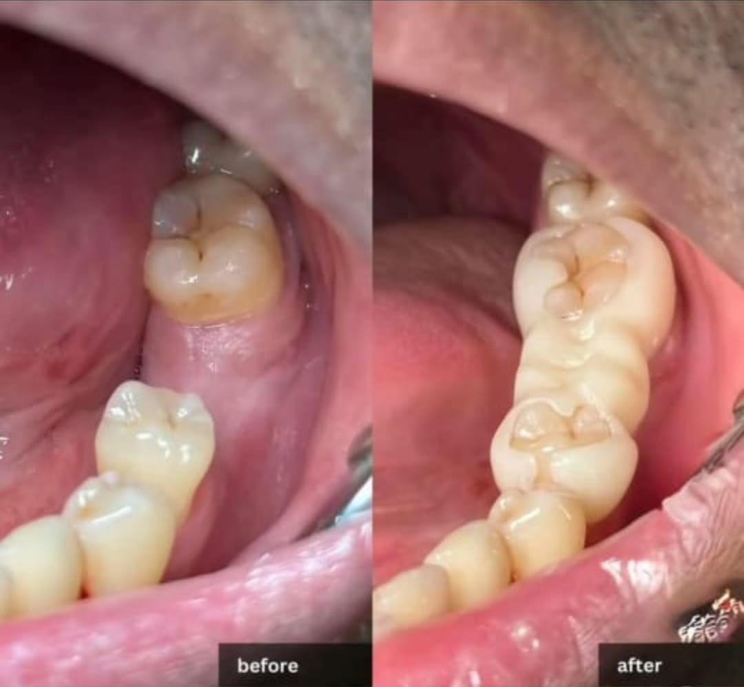 Balaji Dental Clinic