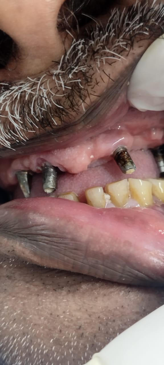 Balaji Dental Clinic