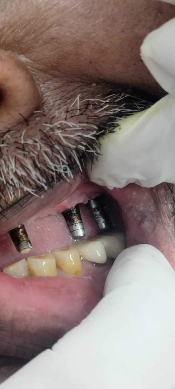 Balaji Dental Clinic