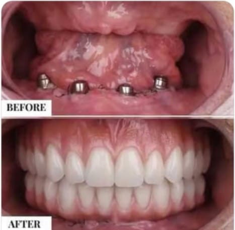 Balaji Dental Clinic