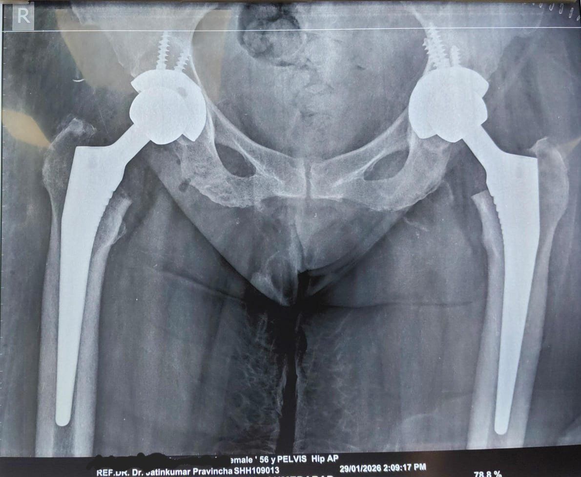 Advance Orthopedic Hospital