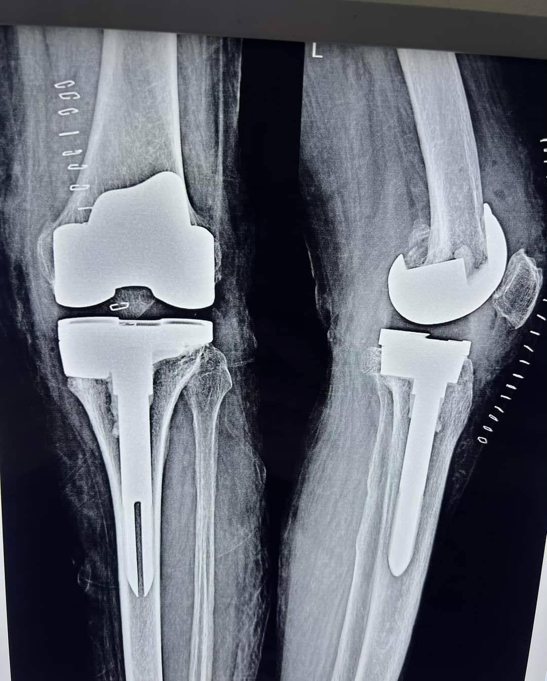 Advance Orthopedic Hospital