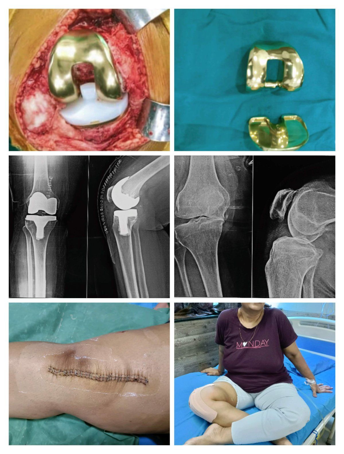 Advance Orthopedic Hospital