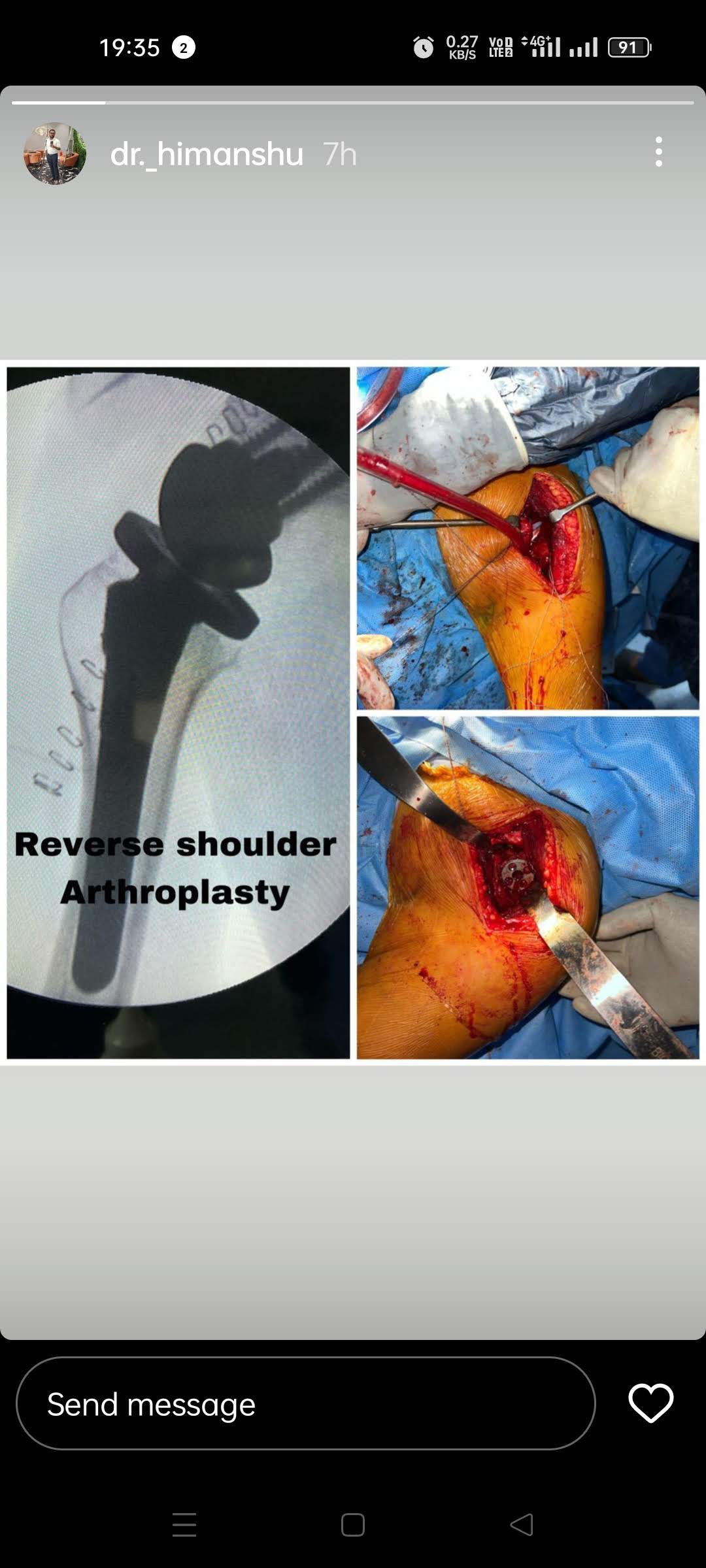 Advance Orthopedic Hospital