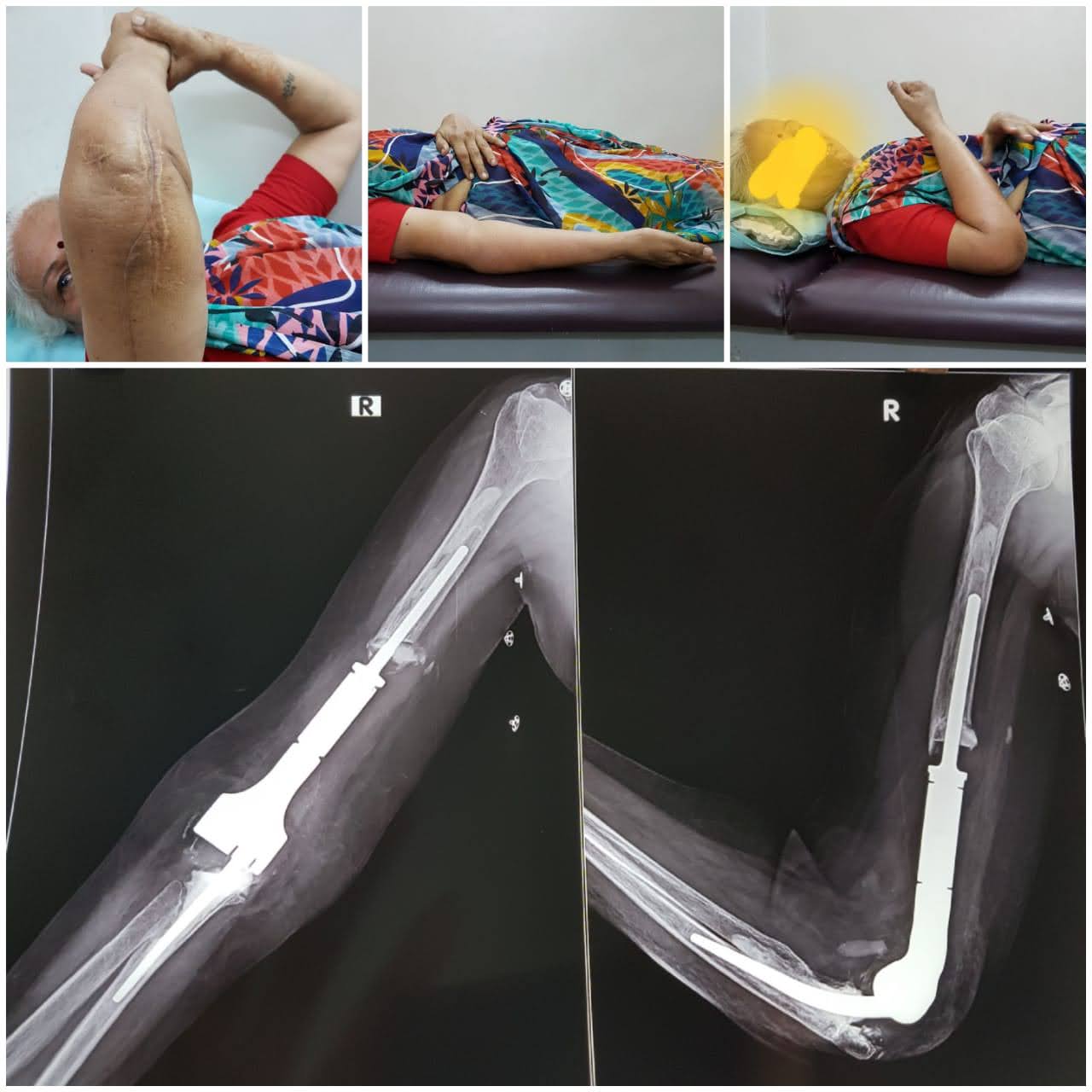 Advance Orthopedic Hospital