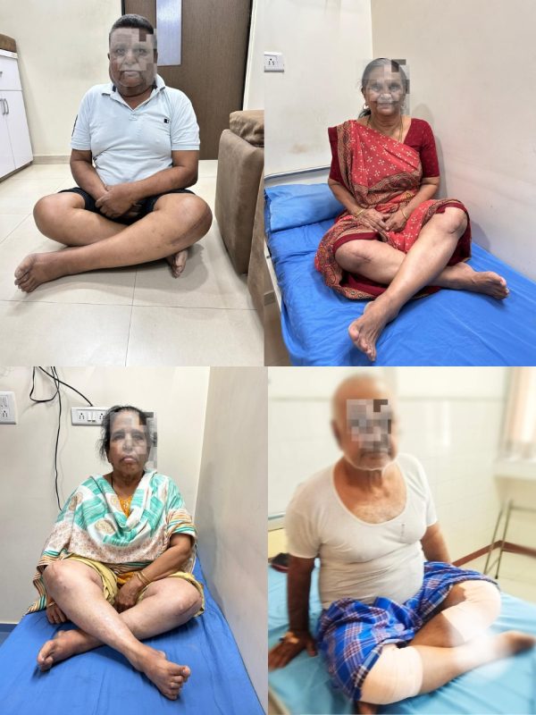 Advance Orthopedic Hospital