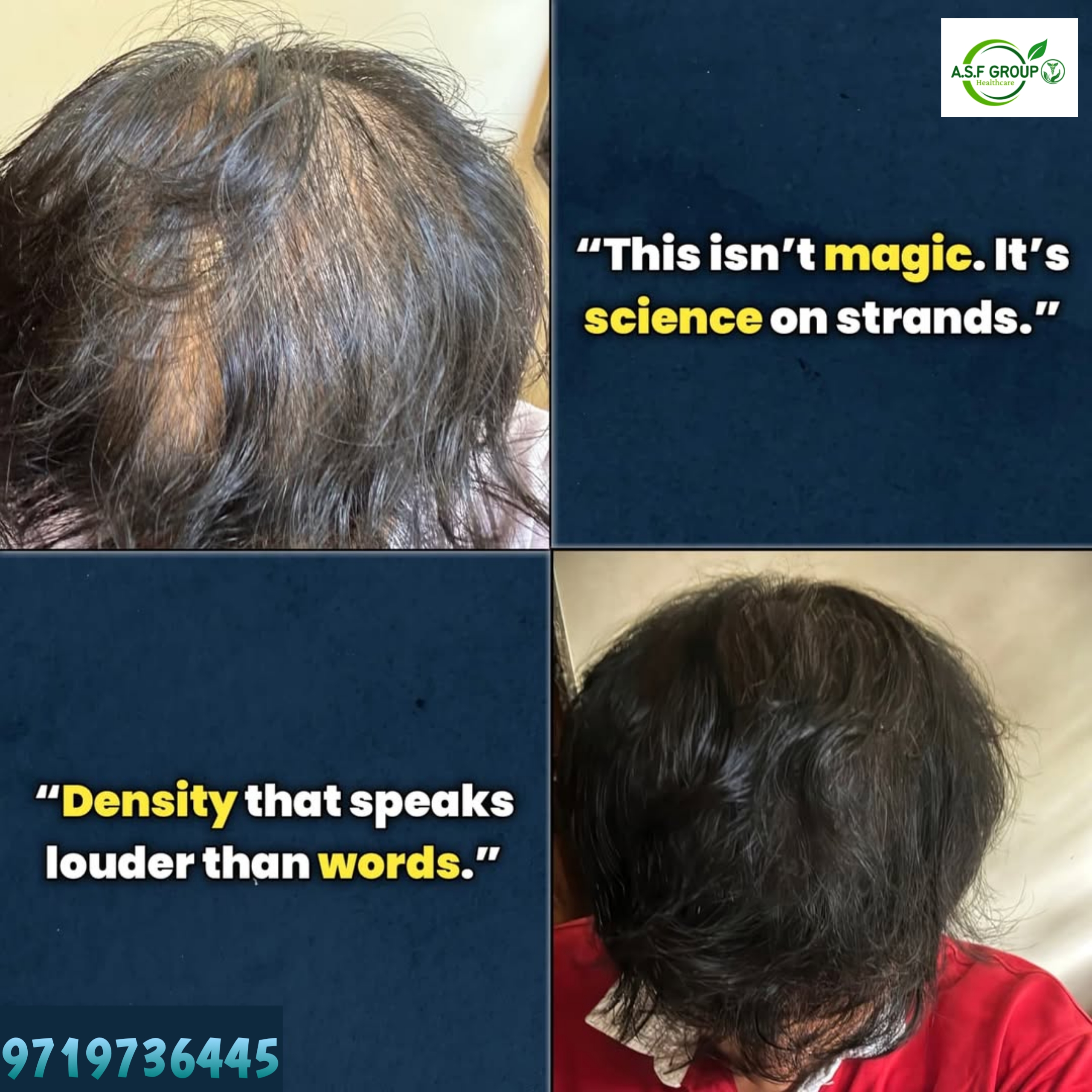 A.S.F GROUP HEALTHCARE ®