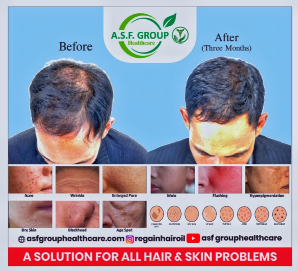 A.S.F GROUP HEALTHCARE ®