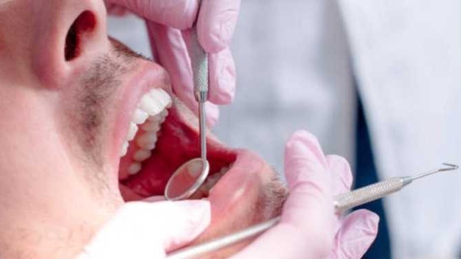 Tooth Extraction Service