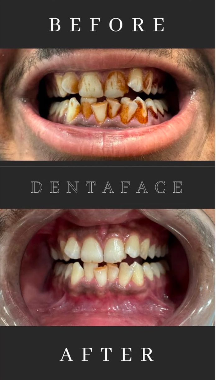 Best Dental Clinic in Sargasan, Gandhinagar - DENTAFACE