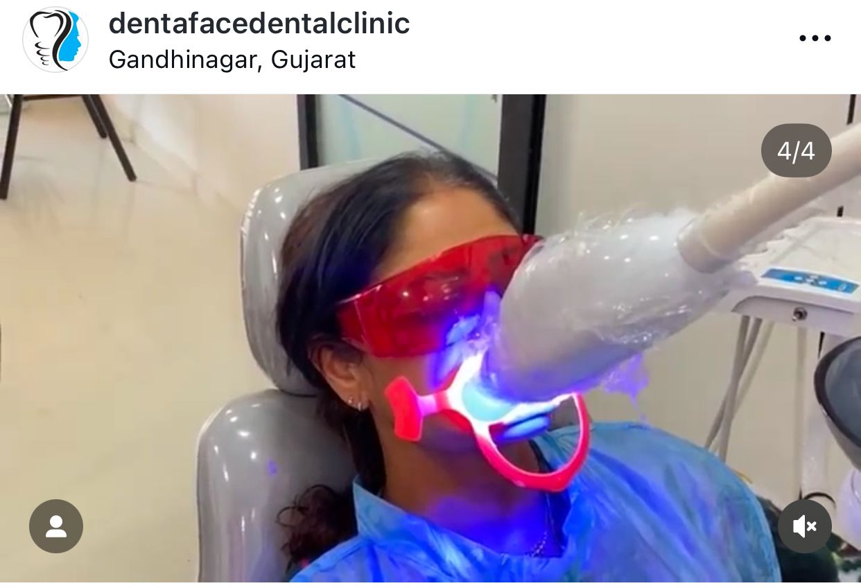 Best Dental Clinic in Sargasan, Gandhinagar - DENTAFACE
