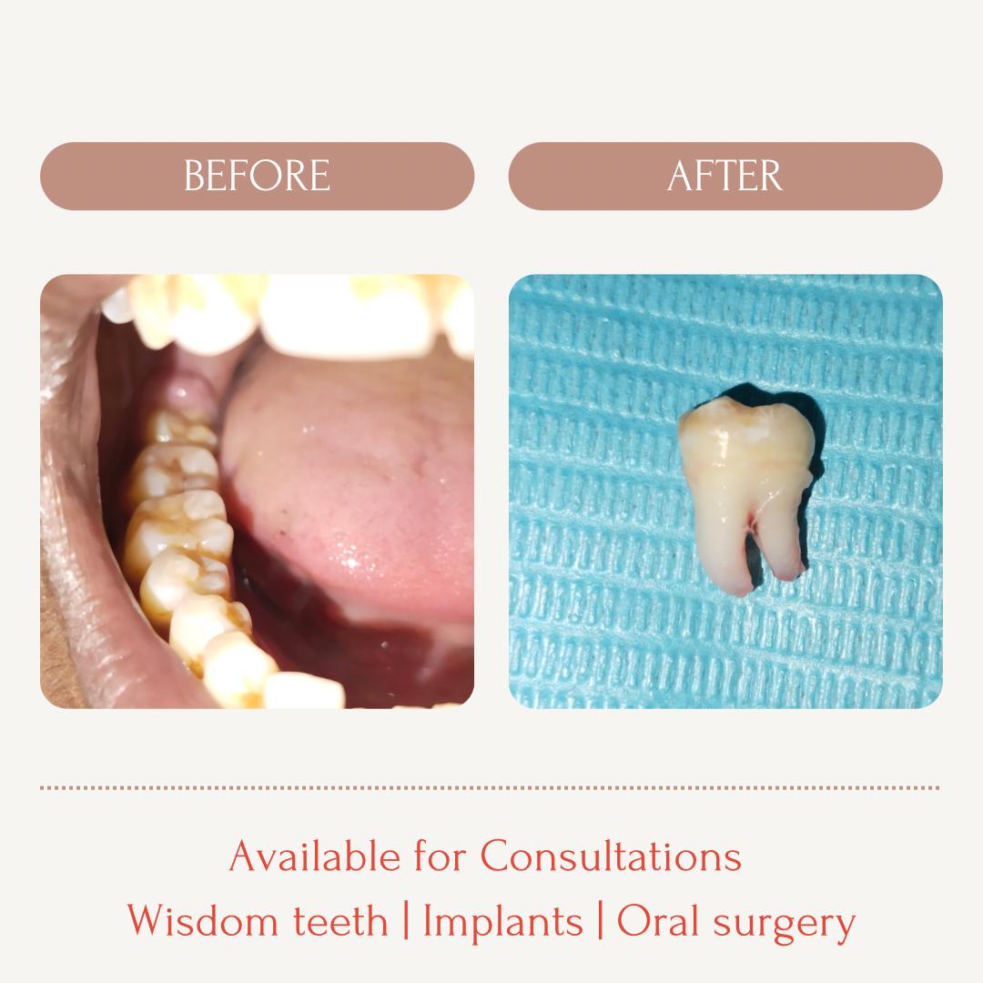 Best Dental Clinic in Sargasan, Gandhinagar - DENTAFACE