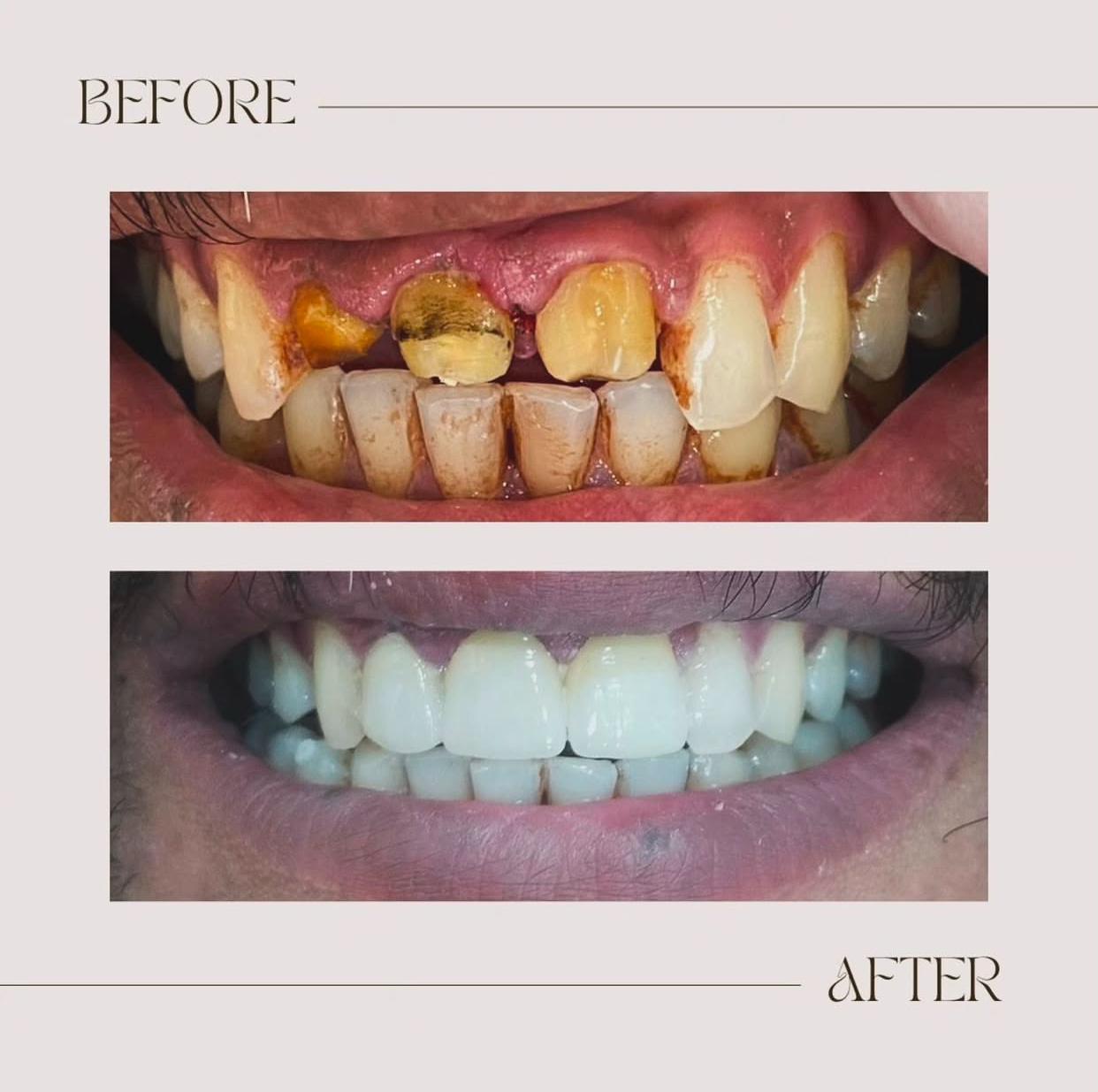 Best Dental Clinic in Sargasan, Gandhinagar - DENTAFACE