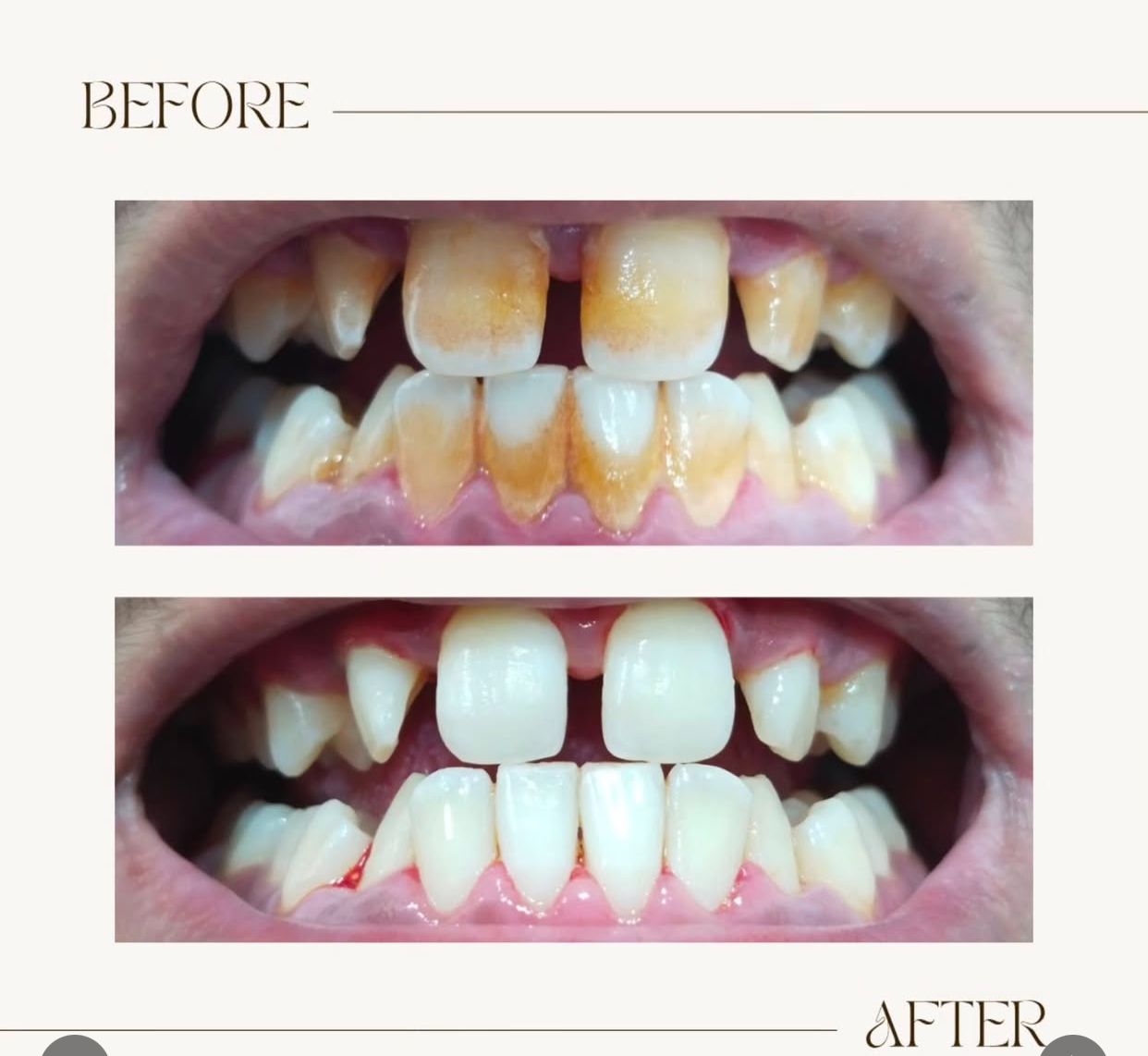 Best Dental Clinic in Sargasan, Gandhinagar - DENTAFACE