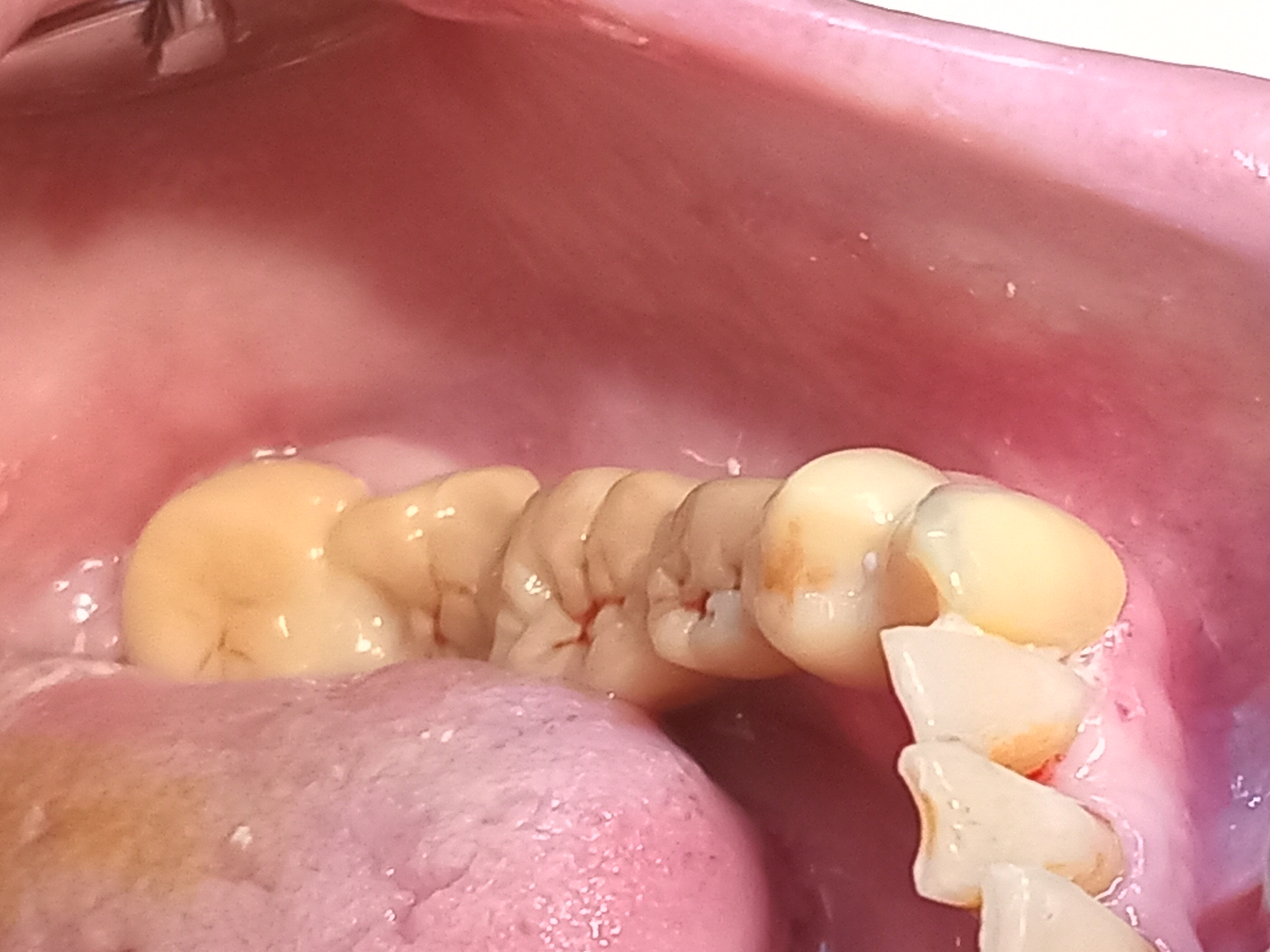 Family Dental Care