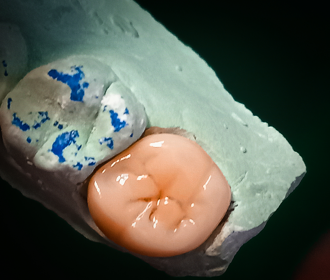 Family Dental Care