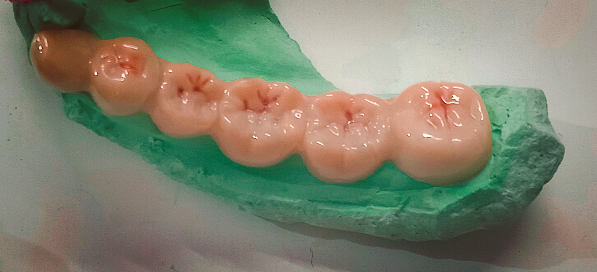 Family Dental Care