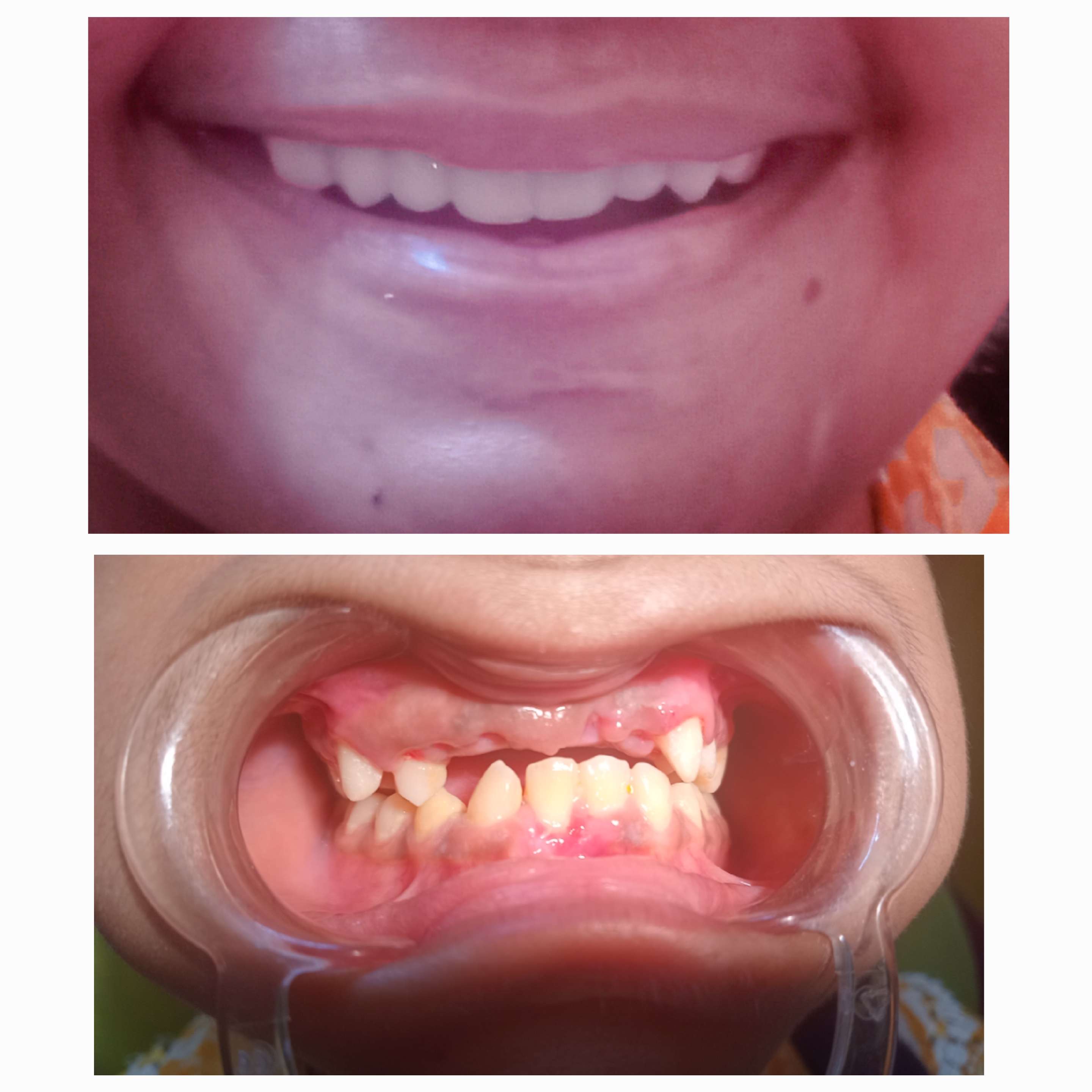Family Dental Care