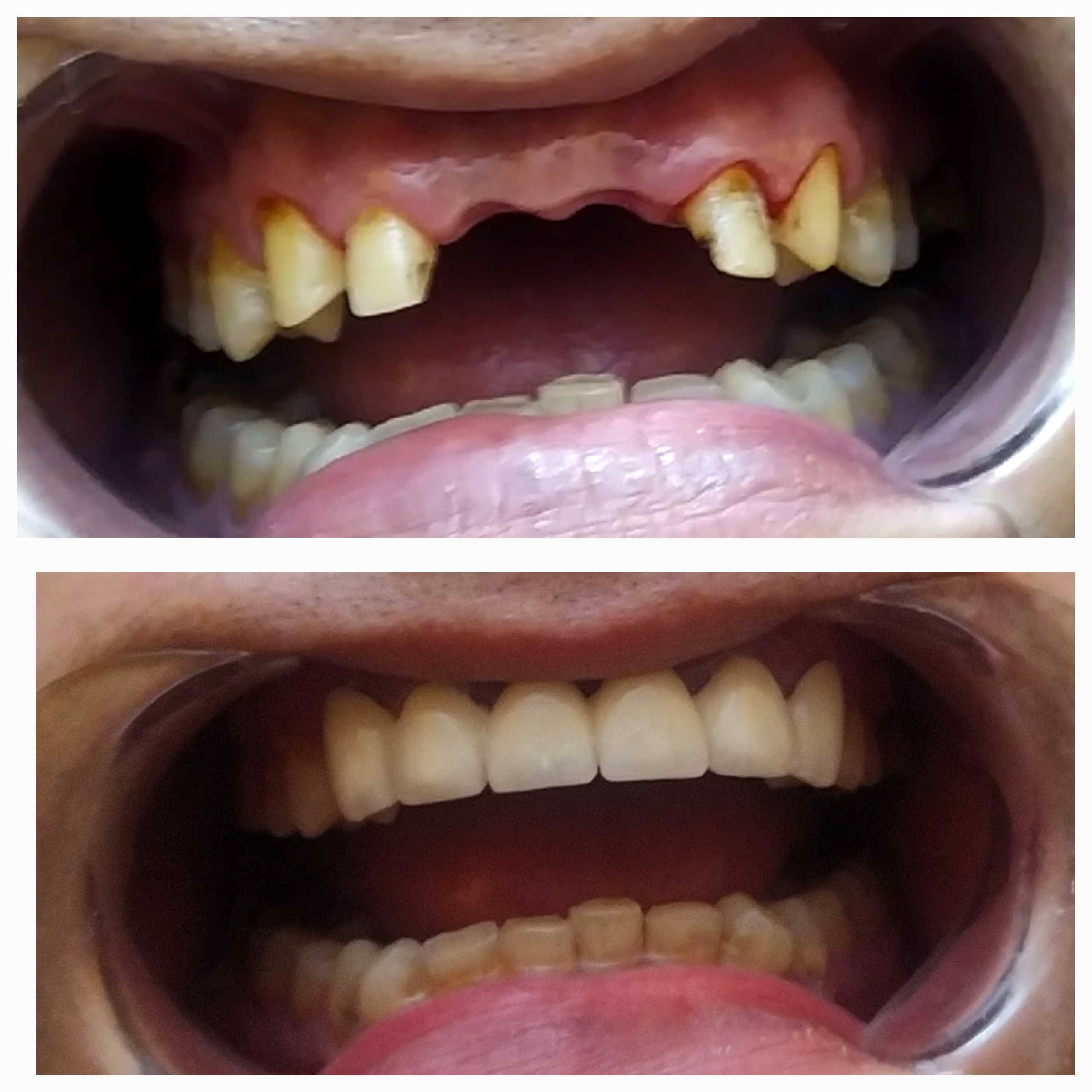 Family Dental Care