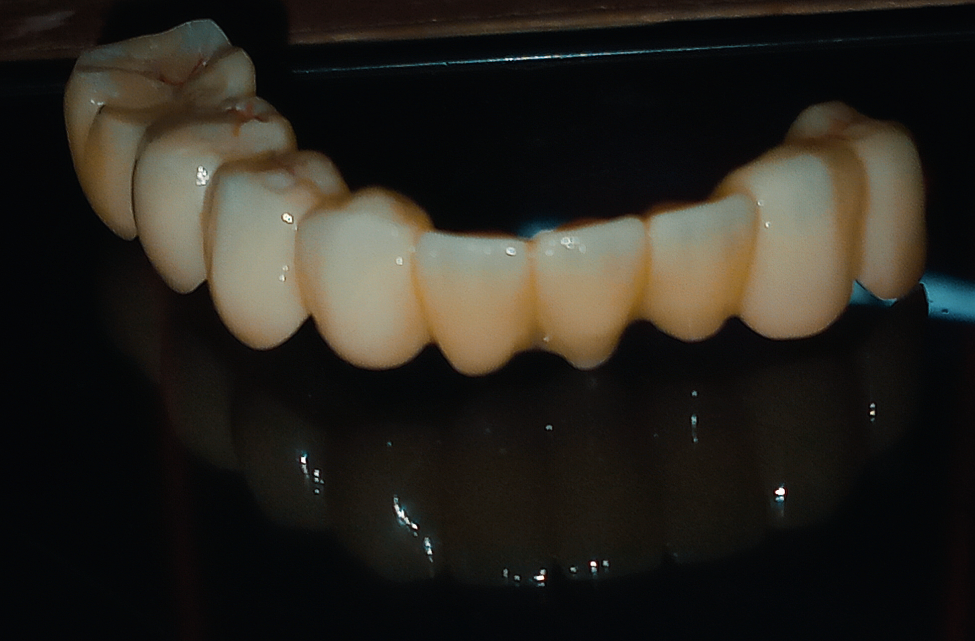 Family Dental Care
