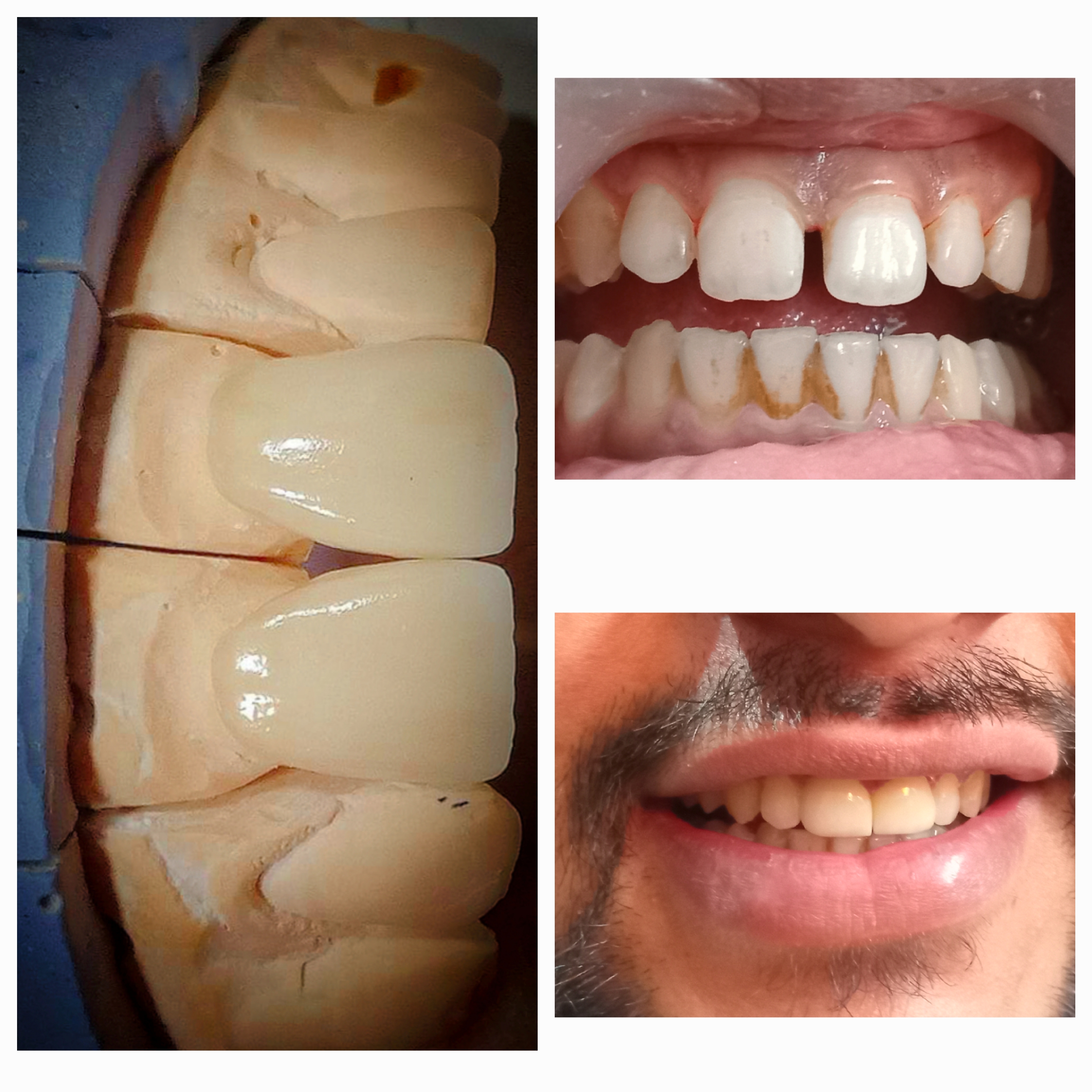 Family Dental Care