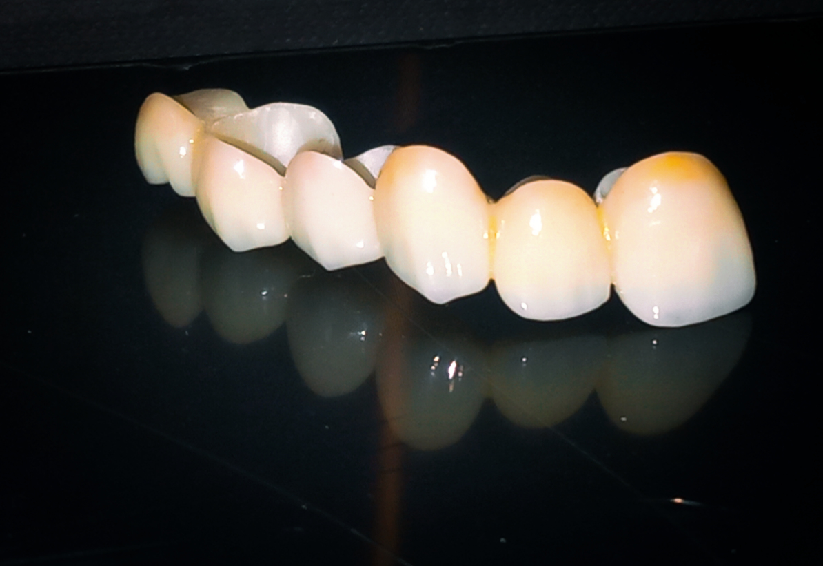 Family Dental Care
