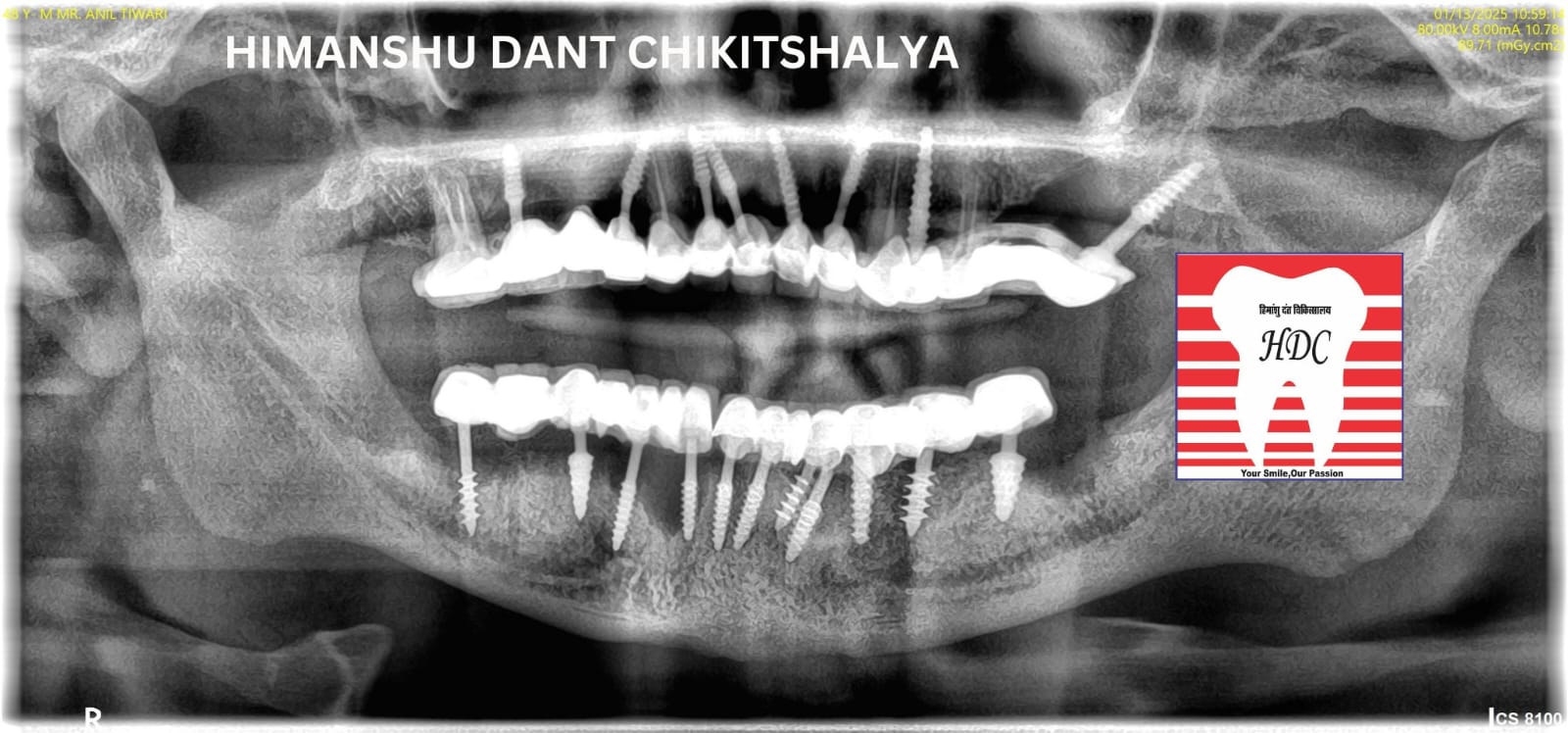 Himanshu Dant Chikitshalya