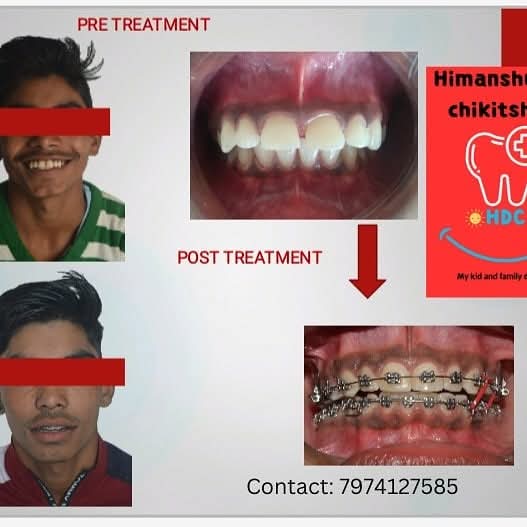 Himanshu Dant Chikitshalya