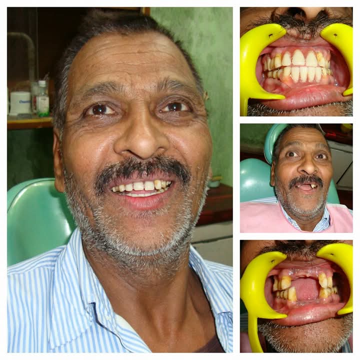 Himanshu Dant Chikitshalya