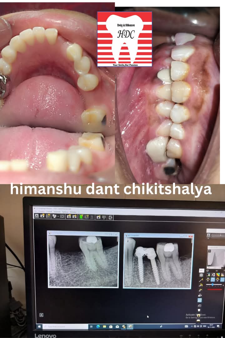 Himanshu Dant Chikitshalya