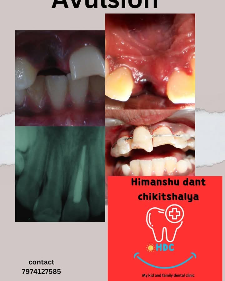 Himanshu Dant Chikitshalya