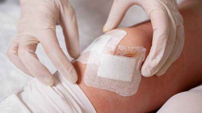 Wound Dressing